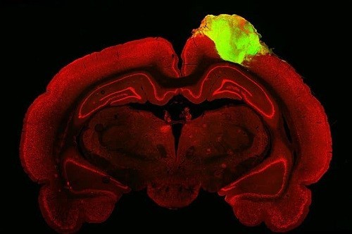 小鼠大脑（红色）与植入的人脑类器官（绿色）